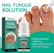 Nail Fungus Solution, Anti Infection Nail Fungus Removal Gel, Ingrown Toenail Treatment Nail Care Oil, Nail Fungus Treatments Serum