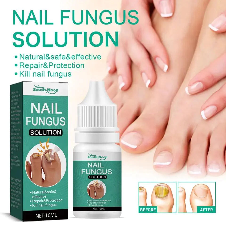 Nail Fungus Solution, Anti Infection Nail Fungus Removal Gel, Ingrown Toenail Treatment Nail Care Oil, Nail Fungus Treatments Serum