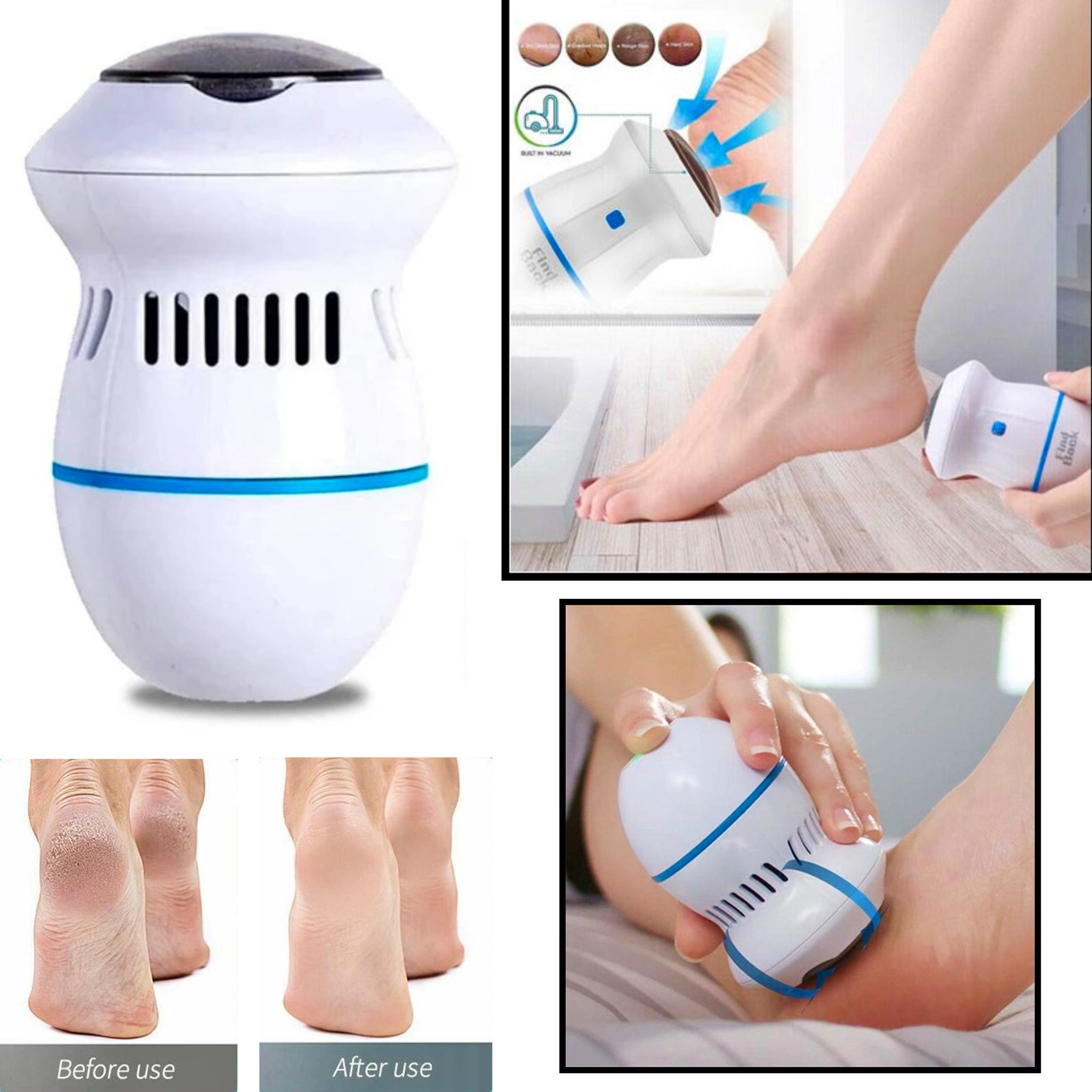 New Original Electric Vacuum Adsorption Foot Grinder Pedicure Tools Foot File Care Tool Remover Absorbing Machine Dead Skin Callus Polisher