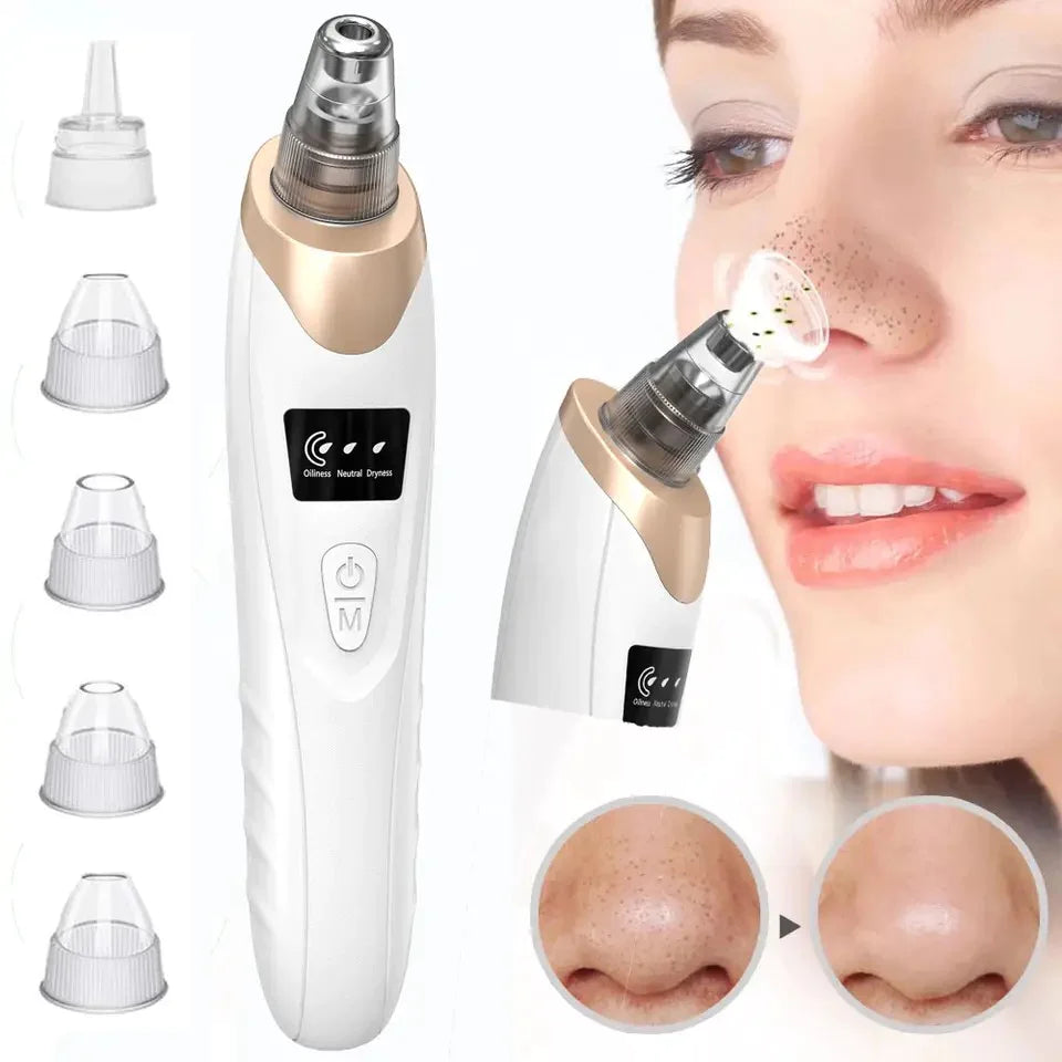 Blackhead Remover Vacuum Acne Cleaner Black Spots Removal